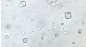 Mikroskopowe zdjęcie kryształu soli zawierającego żywe organizmy/fot. Kathy Benison