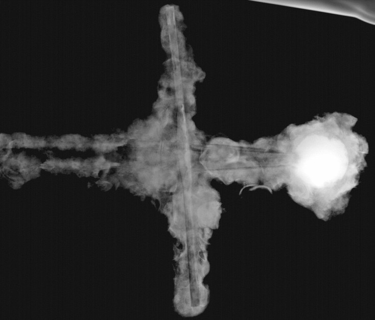 Zdjęcie rentgenowskie miecza wyłowionego z dna morza w Izraelu / / fot. Isaac Hershko/Soreq Nuclear Research Center
