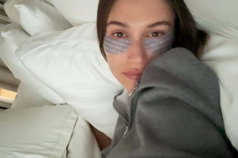 Hailey Bieber con le bende sull'occhio / Instagram @haileybieber